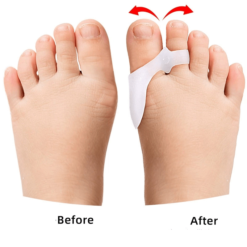 1/2/3Pairs Children's Gel Toe  - Toe Separator Silicon incelemesi ve fiyatı