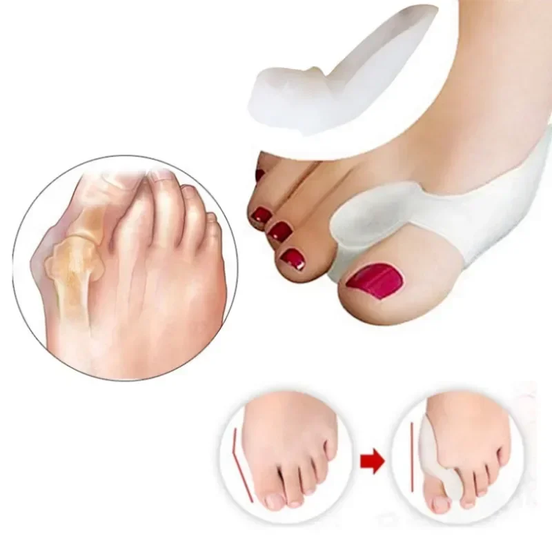 2PCS Silicone Gel Thumb Correc - Toe Separator Silicon incelemesi ve fiyatı