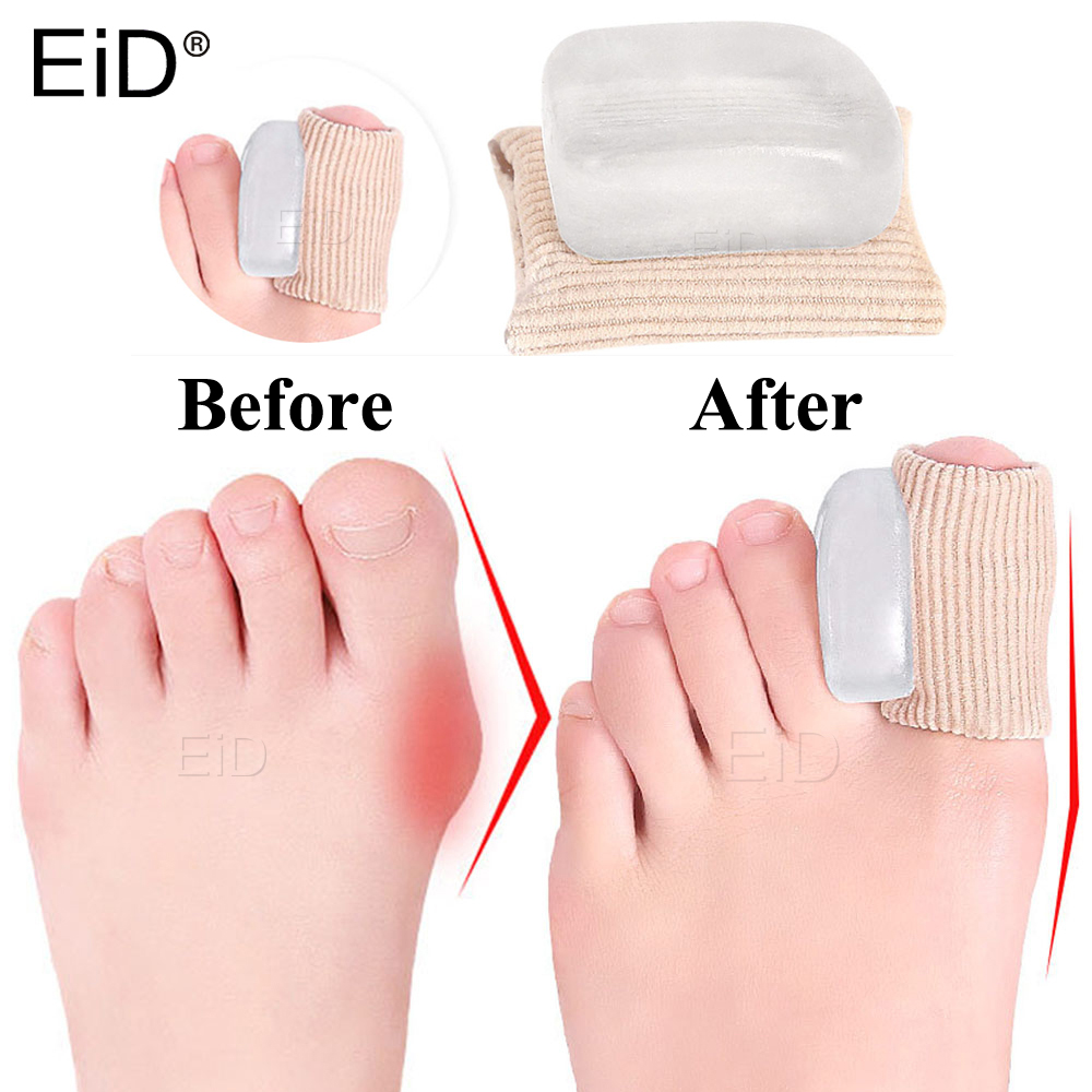 2 PCS Silicone Gel Thumb Corre - Toe Separator Silicon incelemesi ve fiyatı