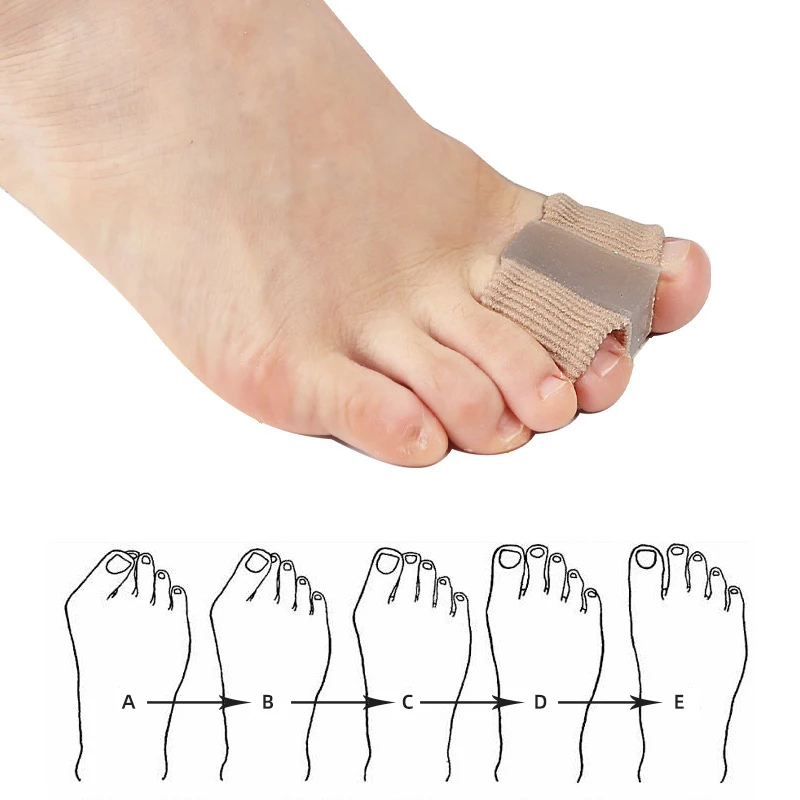 Gel Bunion Toe Separators W/Fa - Toe Separator Silicon incelemesi ve fiyatı