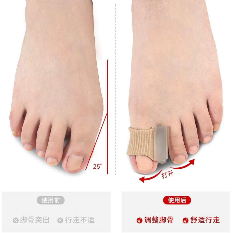 1/10Pcs Gel Toe Separators  Co - Toe Separator Silicon incelemesi ve fiyatı