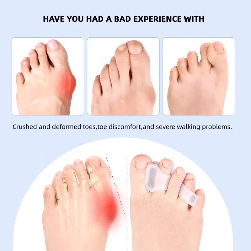 1/2/5Pairs Hallux Valgus Appli - Toe Separator Silicon incelemesi ve fiyatı